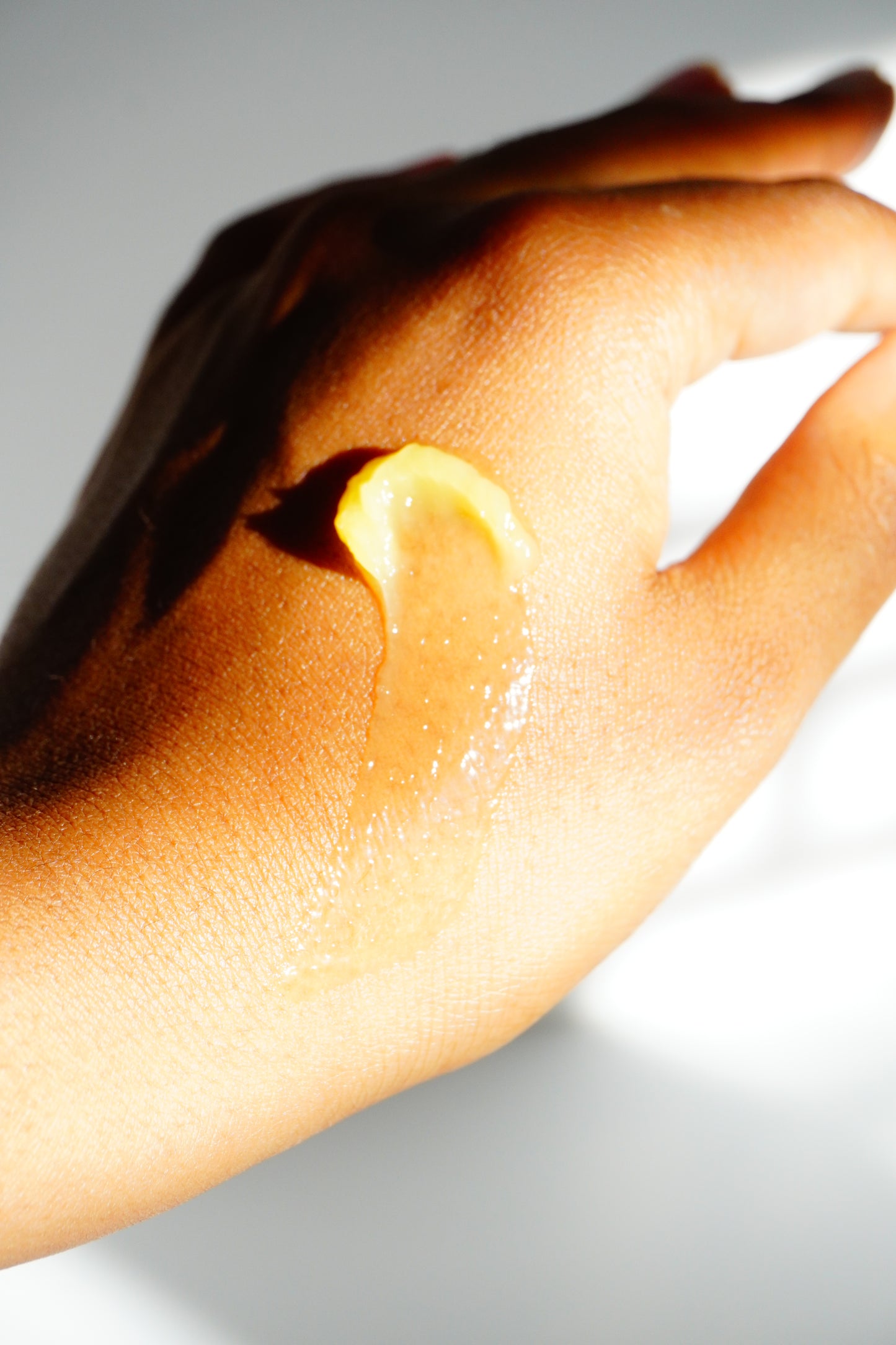 Eczema Be Gone Bundle