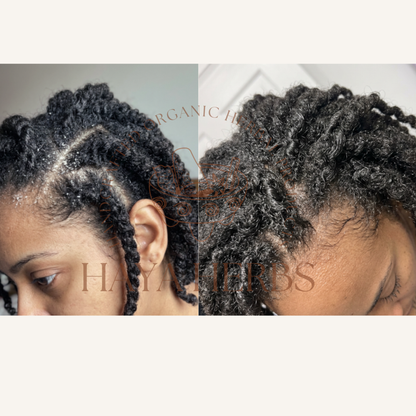 Seborrheic Dermatitis Relief Bundle