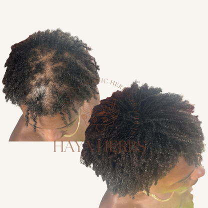 Holistic Hair Repair Bundle