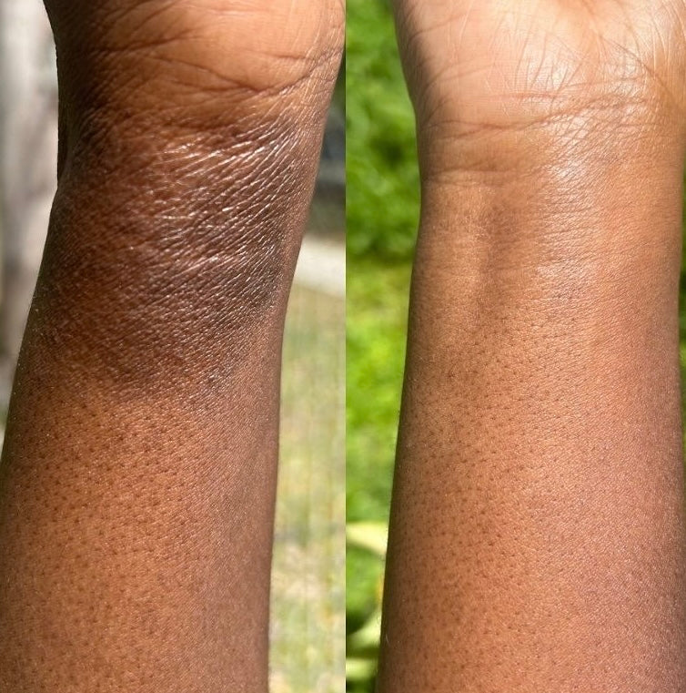 Calendula & Rose Salve