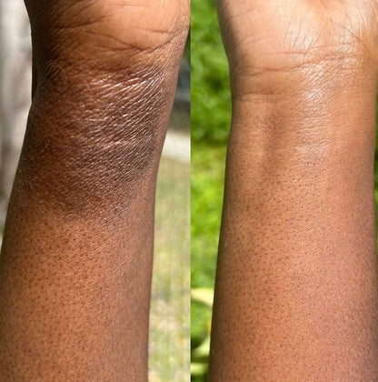 Calendula & Rose Salve