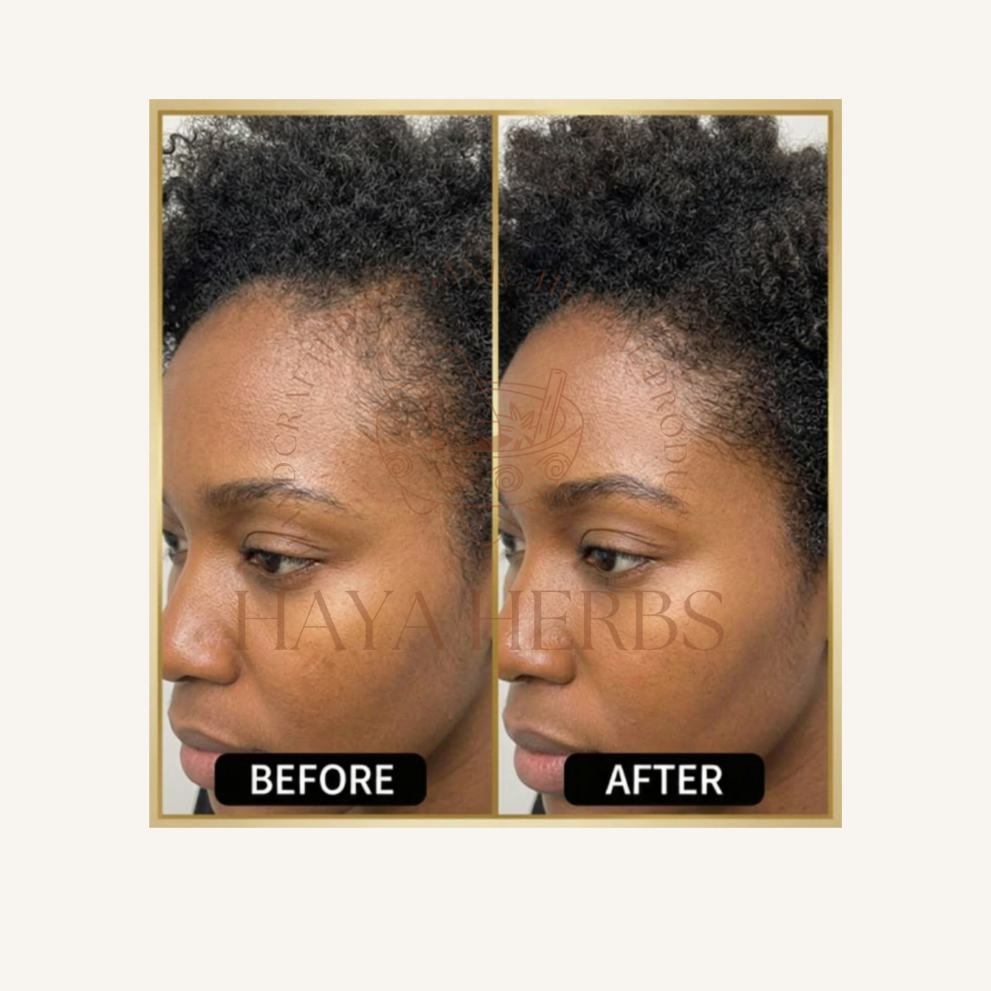 HairVeda Duo
